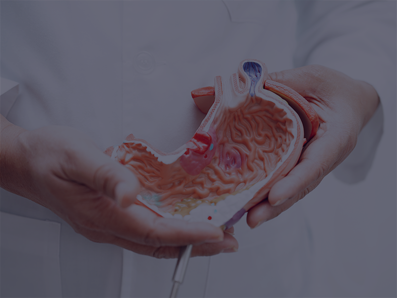 Gastric Balloon — photo 1