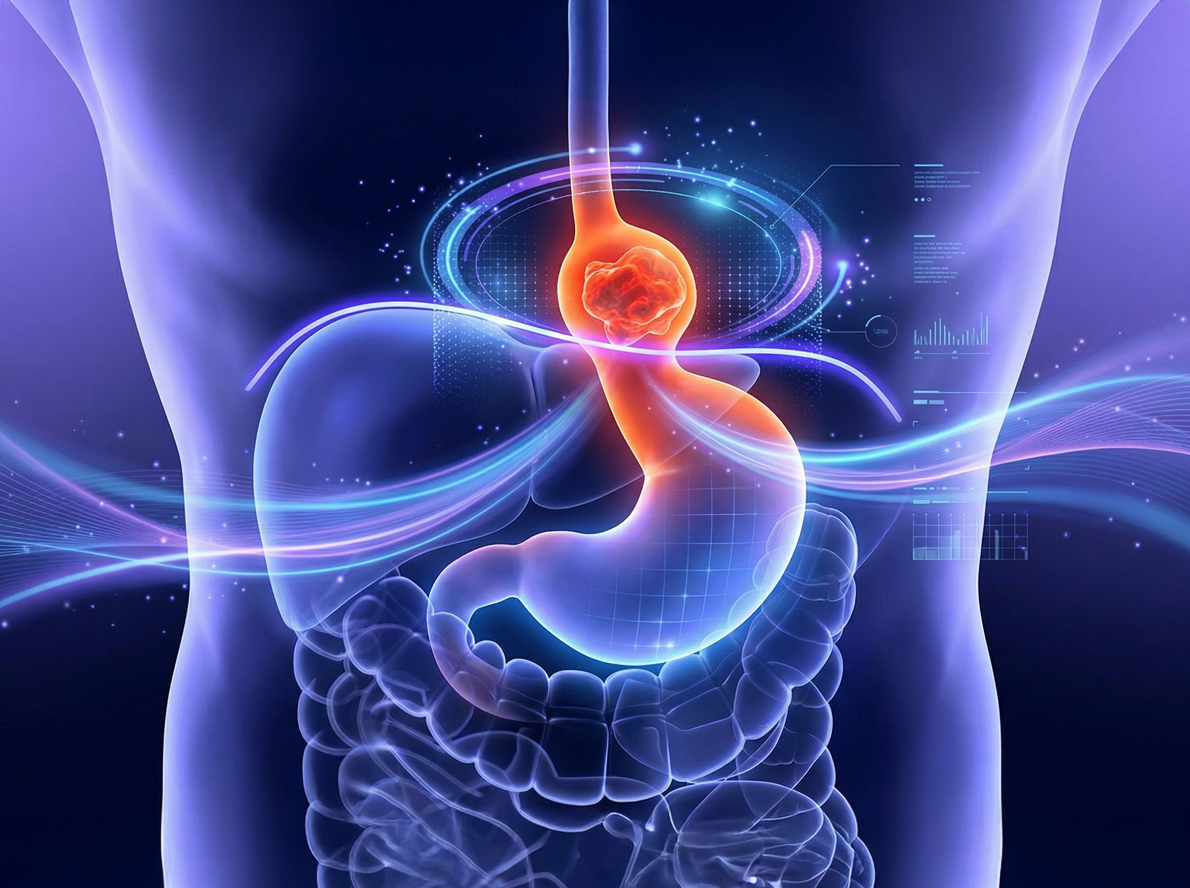 Laparoscopic Hiatal Hernia Repair — photo 1