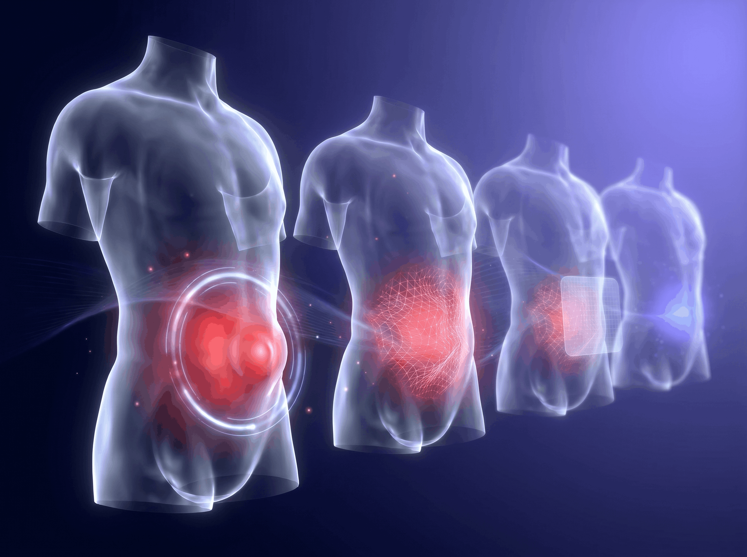 Laparoscopic Hernia Repair — photo 1